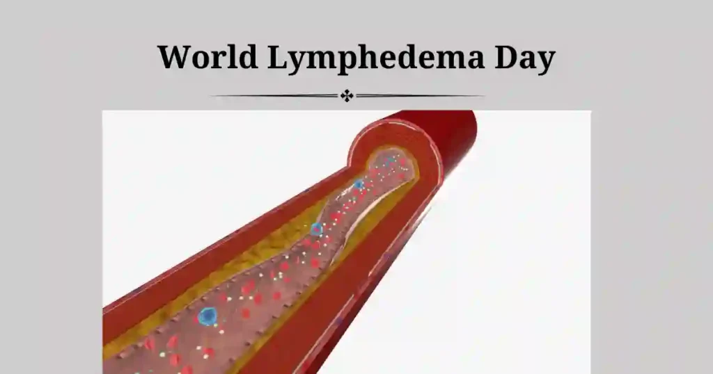 World Lymphedema Day